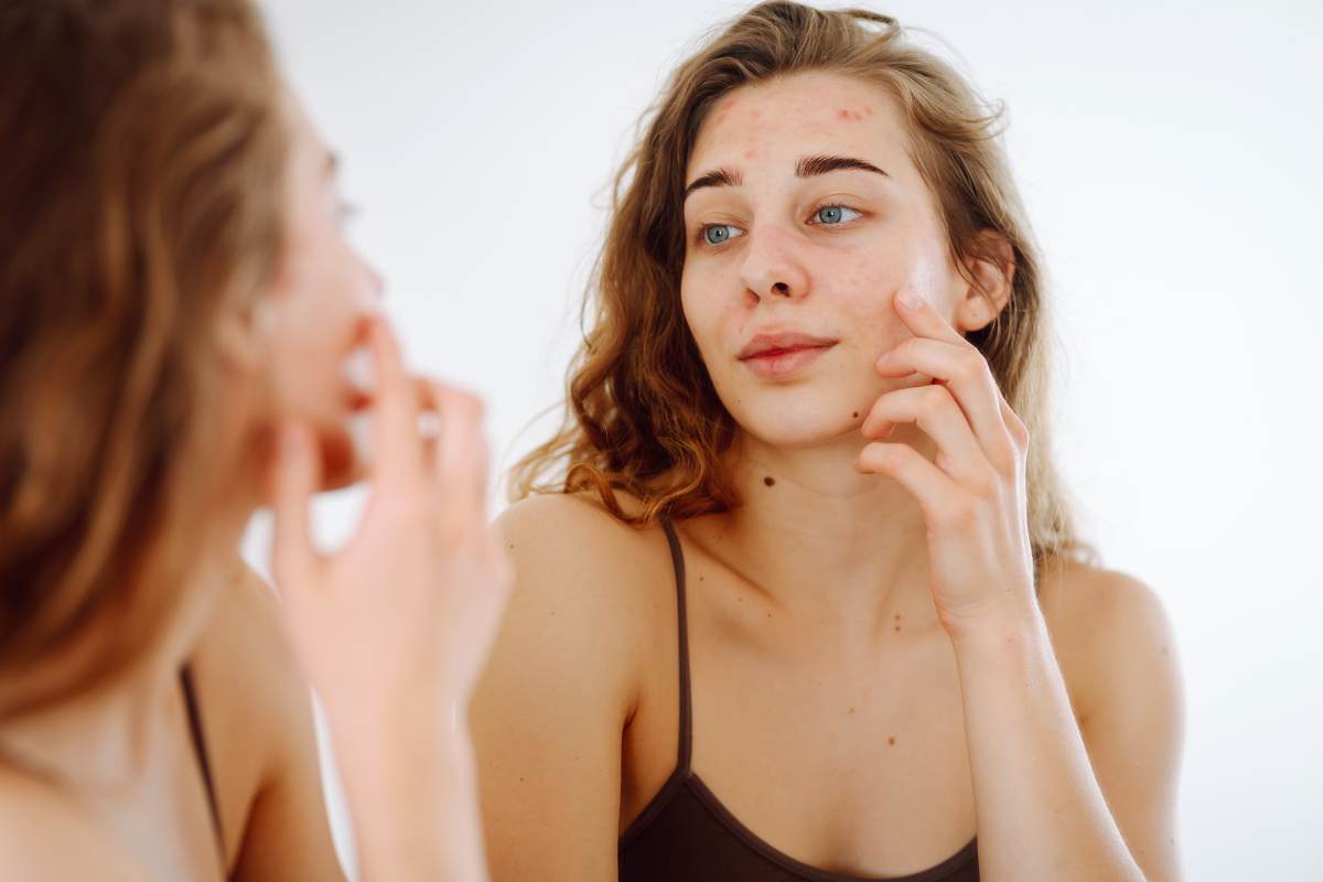 macchia pelle tumore